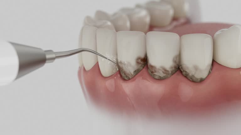 Trusted Tooth Extraction service in White Cloud, MI - Dentist Open Now